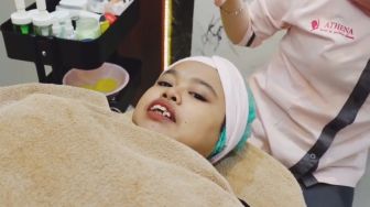 6 Momen Kekeyi Lakukan Perawatan, Hilangkan Double Chin Tapi Tak Mau Ubah Gigi?