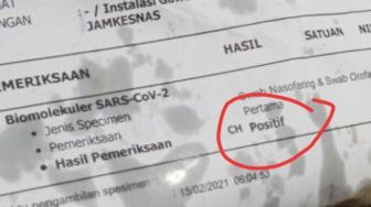 Polres Kota Depok Selidik Bungkus Gorengan Pakai Kertas Surat Swab Positif Covid-19