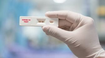 Hasil PCR Positif Setelah 2 Minggu, Harus Tes Ulang?