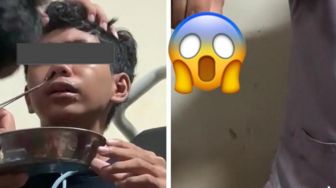 Viral Keluhkan Sering Mimisan, Ternyata Ada Sesuatu Bersarang di Hidung Remaja Ini!