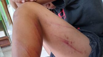 Sabeti Anak Panti di Gresik Pakai Kabel Hingga Memar-memar, Muhaimin Dilaporkan Polisi