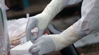 Minahasa Sumbang 63 Kasus Pada 13 Agustus, Sulut 295 Kasus Baru Covid-19