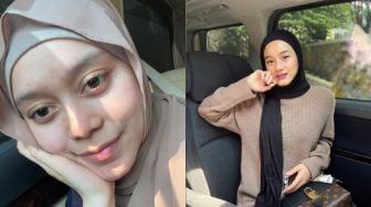 8 Potret Adu Pesona Lesti Kejora Vs Dinda Hauw Tanpa Make Up