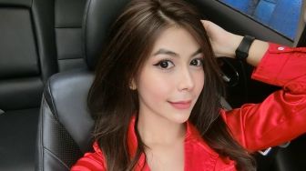 Gara-Gara Pamer Ketiak, Model Kimberly Irene Ditawar Seorang Publik Figur