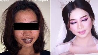 Transformasi Wajah Perempuan Penuh Noda Hitam Jadi Cantik Bak Princess Ini, Banjir Pujian