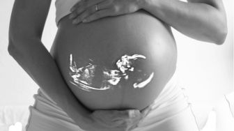 Mengenal Pemeriksaan NIPT, Deteksi Dini Kelainan Kromosom Pada Bayi di Dalam Kandungan