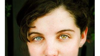 Unik! Heterochromia: Kelainan Mata yang Membuat Warna Iris Berbeda