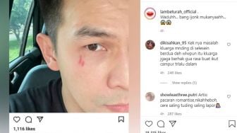 Wajah Jonathan Frizzy Luka, Benny Simanjuntak: Anak Saya Ijonk