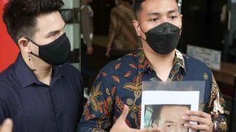 Aktor Jonathan Frizzy menunjukkan bukti penganiayaan usai diperiksa di Polres Metro Jakarta Selatan, Senin (27/9/2021). [Suara.com/Alfian Winanto]