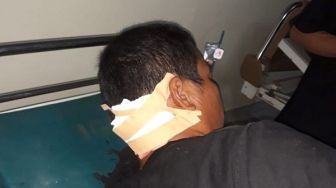 Pulang Kondangan Warga Luwung Kencana Dibacok Begal, Honda PCX Dibawa Kabur