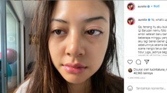 Wajah Aurelie Moeremans Berubah Gegara Alami Tumor Colli, Penyebabnya Apa Sih?