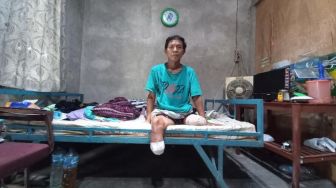 Pria di Bantul Kehilangan Kaki karena Penyakit Langka, Hanya Ada Dua di Indonesia