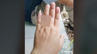 Haru! Belum Bisa Melamar, Pria Ini Persembahkan Cincin Tak Biasa untuk Pacar