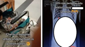 Viral Ibu Panik Anaknya Telan 6 Baterai, Dokter dan Perawat Syok Lihat Hasil Sinar X