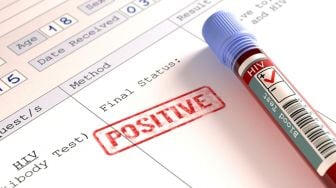Banyuwangi Catat 286 Kasus HIV/AIDS Sepanjang 2021