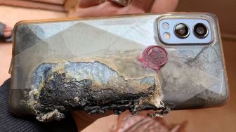 HP OnePlus Terbakar hingga Lukai Pengguna, Perusahaan Tanggung Biaya Pengobatan