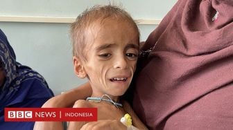 Bayi-bayi Afghanistan Kelaparan, RS Kesulitan, Rasanya seperti di Neraka