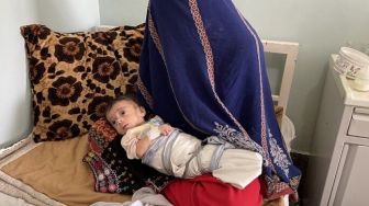 Ini Krisis Kemanusiaan yang Dibeberkan Sejumlah Dokter di Afghanistan, Ngeri!