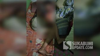Seorang Anak di Sukabumi Jadi Korban Kekerasan, Kuku Jarinya Dicabut