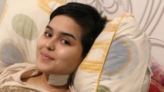 Laura Anna Meninggal, Dokter Tirta Ungkap Beratnya Perjuangan Pasien Spinal Cord Injury