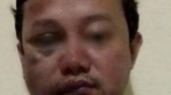 Komnas HAM Tak Setuju Pemerkosa 13 Santriwati di Bandung Dihukum Mati