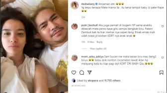 Unggah Foto Wajah Lebam, Sheila Marcia Dikira Korban KDRT