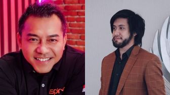 4 Artis Lakukan Transplantasi Rambut, Anang Hermansyah Tampil Botak