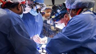 Pertama Dalam Sejarah, Dokter Berhasil Transplantasi Jantung Babi ke Tubuh Manusia