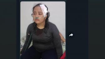 Viral! Perempuan Jadi Korban Begal di Kubu Raya, Pelaku Diduga Bawa Lari Uang Rp 60 Juta
