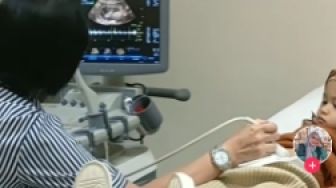 Kocak! Video Viral Balita di-USG Dokter Tersebar, Ditonton 4,2 Juta Kali