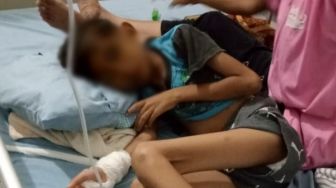 Bocah Penderita Sakit Paru Dirawat di RSUD Pirngadi Gratis, Atensi Wali Kota Medan Bobby Nasution
