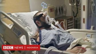 Pasien Jantung Tolak Vaksin, RS di AS Juga Tolak Operasi Transplantasinya