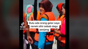 Dulu Diejek Mirip Nenek Sihir, Penampilan Wanita Ini setelah Jalani Operasi Rahang Bikin Pangling