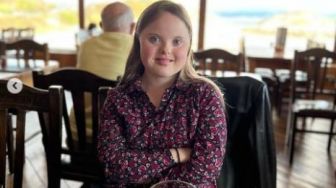 Makin Percaya Diri, Cerita Wanita Down Syndrome yang Kini Sukses Debut Jadi Model
