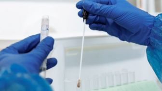 Kasus COVID-19 Meningkat, PB IDI Minta Pemerintah Wajibkan Kembali Tes PCR Sebagai Syarat Perjalanan