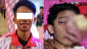 Butuh Bantuan, Atlet Karate Idap Tumor Ganas di Mata Hanya Bisa Terbaring di Tempat Tidur