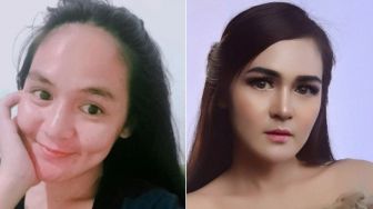 10 Potret Terbaru Chaca Mantan Istri Andika Kangen Band Setelah Rehabilitasi, Makin Glowing!