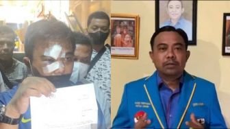 Dalang di Balik Aksi Debt Collector Keroyok Ketum KNPI, Politisi Golkar Azis Samual Terancam Penjara 9 Tahun