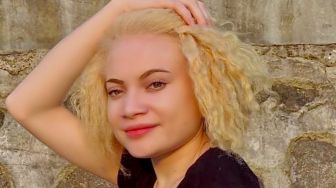 Profil dan Biodata Herolena Beroperay, Gadis Albino Asli Papua yang Curi Perhatian