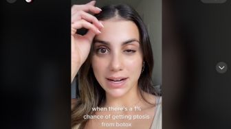 Viral di TikTok! Perempuan Sulit Buka Mata Gegara Suntik Botox