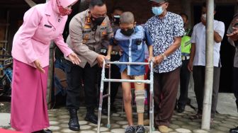 Kisah Kiki Warga Demak, Kakinya Harus Diamputasi Akibat Kanker Tulang, Kini Bisa Jalan Lagi dengan Kaki Palsu