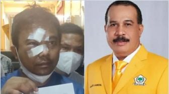 Haris Pertama Duga Pengeroyokan Dirinya Terkait Persoalan Internal Golkar