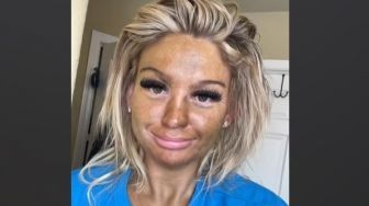 Ingin Punya Kulit Wajah Tanning, Wanita Ini Malah Apes Penampilannya Jadi Begini