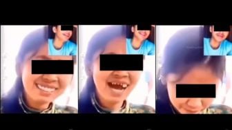 Apes! Gigi Palsu Cewek Tak Sengaja Copot Saat Asyik Video Call, Sikap Cowoknya Langsung Tuai Pujian