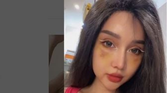 Lucinta Luna Diakui Cantik Usai Oplas Wajah, Warganet: Tapi Jangan Ngomong