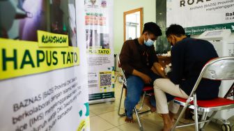 Petugas menghapus tato peserta saat program hapus tato di Masjid Assahara, Kembangan, Jakarta Barat, Rabu (13/4/2022). [Suara.com/Alfian Winanto]