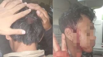 Warga Medan Luka-luka Dikeroyok Belasan Orang Gegera Salip Gerombolan Pemuda Bermotor