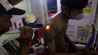 Petugas menghapus tinta tato dengan menggunakan laser saat kegiatan hapus tato gratis di Kantor Sekretariat DPP Forum Ulama Habaib (Fuhab), Jakarta, Selasa (19/4/2022). [Suara.com/Angga Budhiyanto]