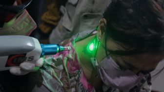 Petugas menghapus tinta tato dengan menggunakan laser saat kegiatan hapus tato gratis di Kantor Sekretariat DPP Forum Ulama Habaib (Fuhab), Jakarta, Selasa (19/4/2022). [Suara.com/Angga Budhiyanto]