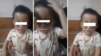 Kebangetan! Ibu Tega Aniaya Anak Gara-gara Buang Air Kecil di Celana, Matanya Sampai Bengkak Membiru